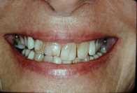 Smile Before