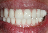 Smile After