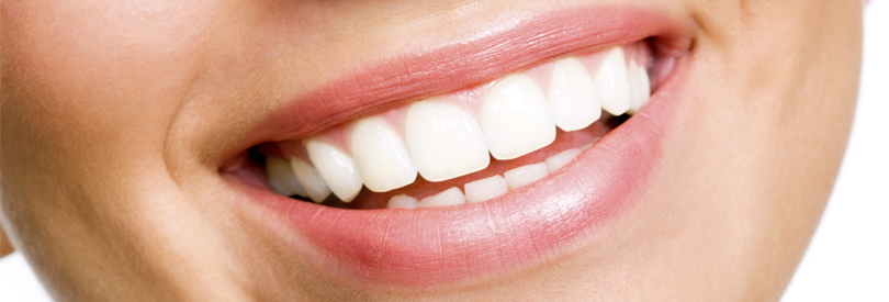 Tooth Colored Fillings Long Island