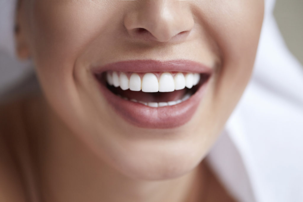 Tooth-Colored Fillings 