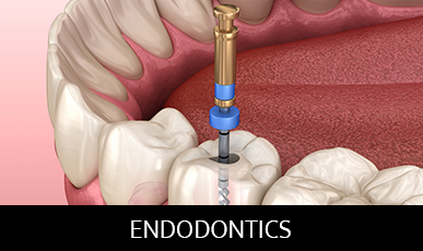 ENDODONTICS