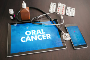 Oral cancer (cancer type) diagnosis medical concept on tablet screen with stethoscope.