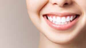 A close-up shot of a woman's smile after getting porcelain veneers in Nassau County
