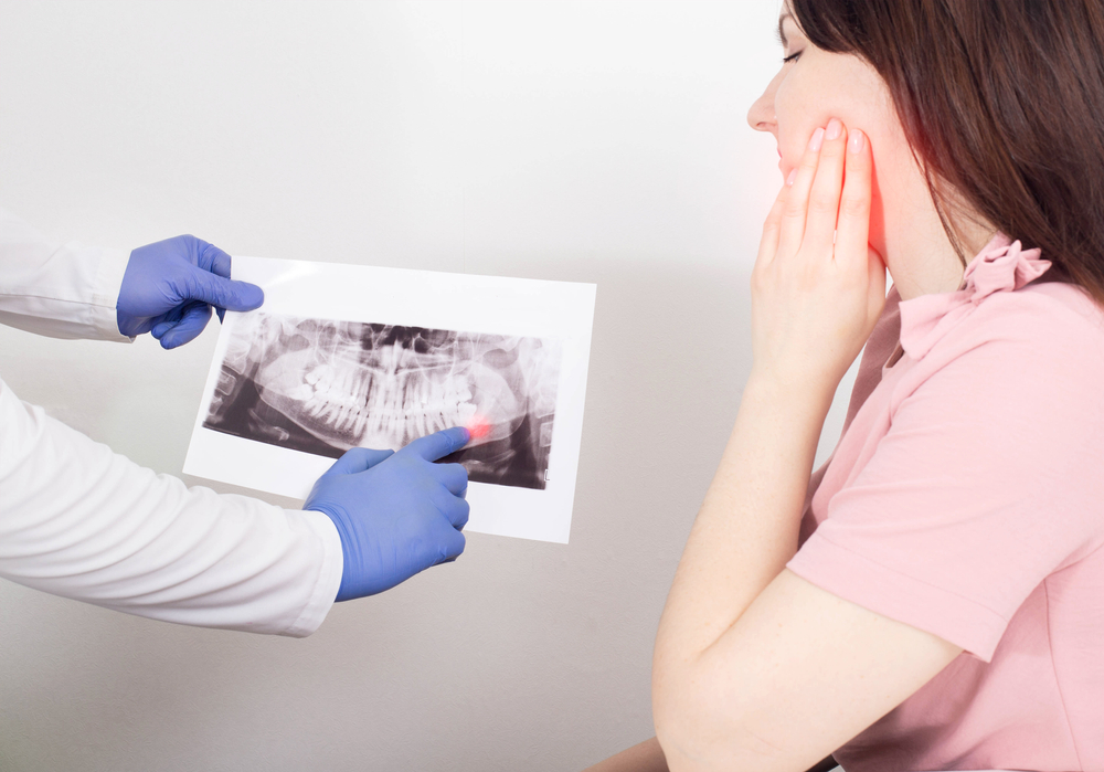 wisdom tooth removal planning