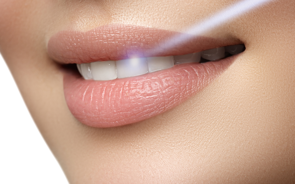 laser dentistry