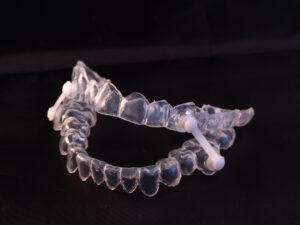 shutterstock 1077168581 oral appliance for sleep apnea